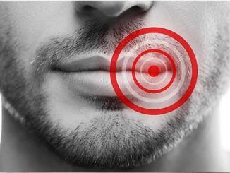 Herpes labial: siete de cada diez españoles podrían desarrollarlo