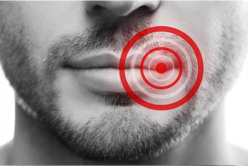 Herpes labial: siete de cada diez españoles podrían desarrollarlo