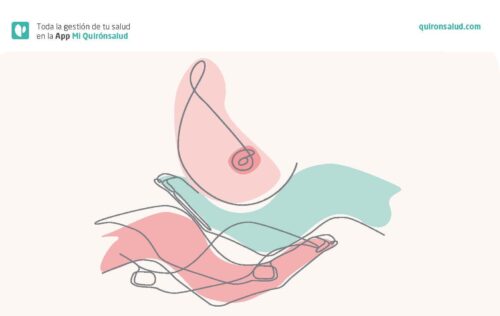 Quirónsalud Málaga celebra una jornada de puertas abiertas entre especialistas y pacientes con cáncer de mama